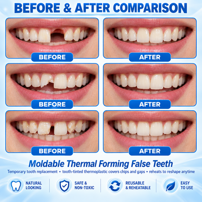 BBOJI® Moldable Thermal Forming False Teeth – Temporary Tooth Repair for Bone Loss & Tooth Shifting Support