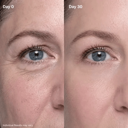 🔥P7 Eye Renewal Cream